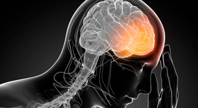 A migrén és a tanulási képességek összefüggéseit vizsgálták szegedi kutatók