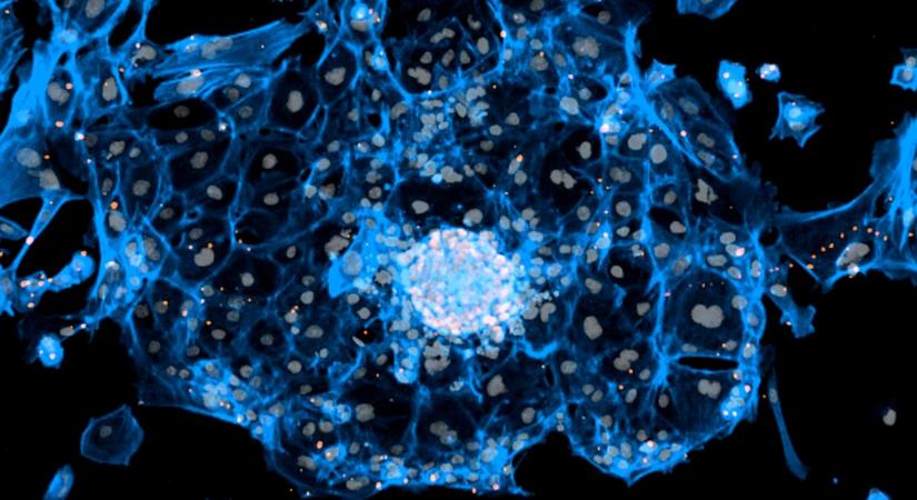Kutatók korai embriókat hoztak létre bőrsejtekből
