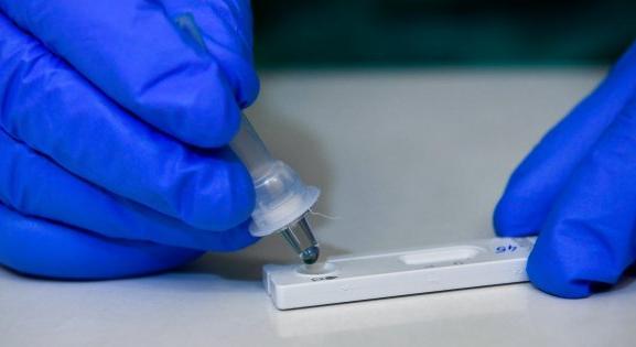 Gyógyszerész: Tévhit, hogy az antitest-teszt kimutatja a védettséget