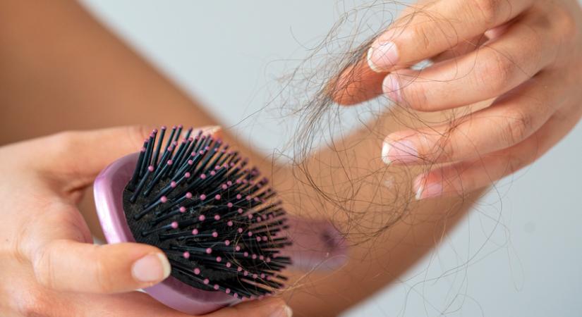 Covid-fertőzés után akár 6-9 hónapon át tarthat az intenzív hajhullás: mikor kell orvoshoz fordulni?