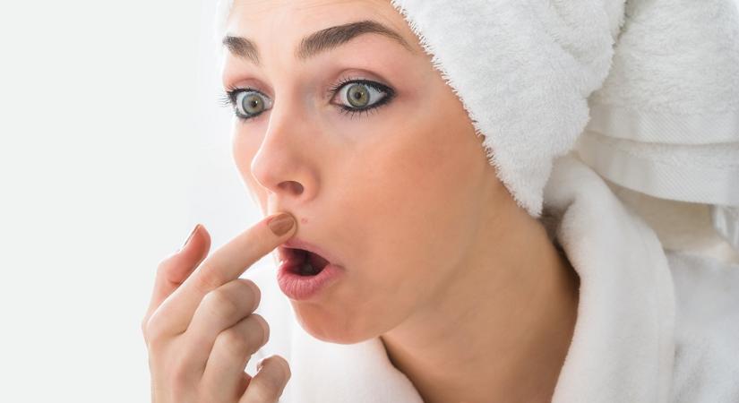6 tipp, hogy eltüntesd a száj körüli pattanásokat