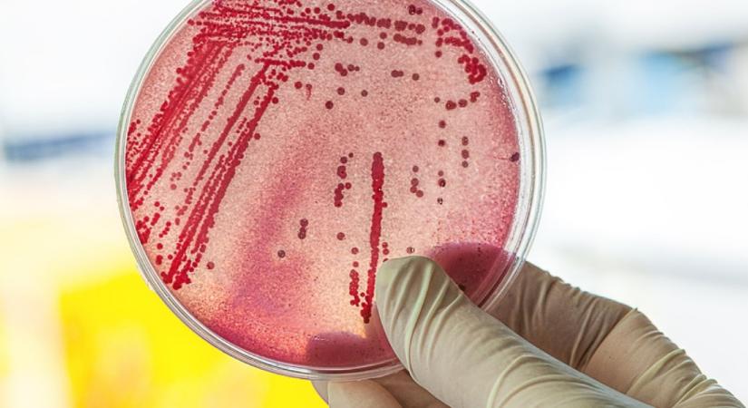 Ezen a használati tárgyon hemzseg a legtöbb baktérium, mégsem tisztítjuk soha