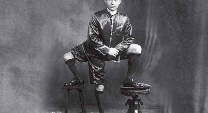 Egy háromlábú, kétpéniszű szicíliai férfi volt a 19. századi cirkuszok gigasztárja