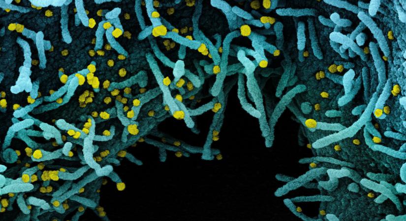 Találtak egy 40-70 éves vírust, amely 96 százalékos egyezést mutat a COVID-19-cel