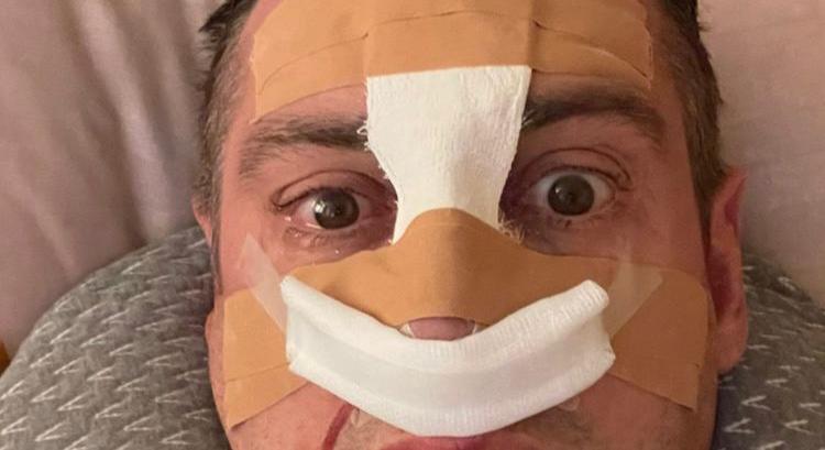 Szegedi Fecsó a kórházi ágyról posztolt: így néz ki a beavatkozás után - Fotó