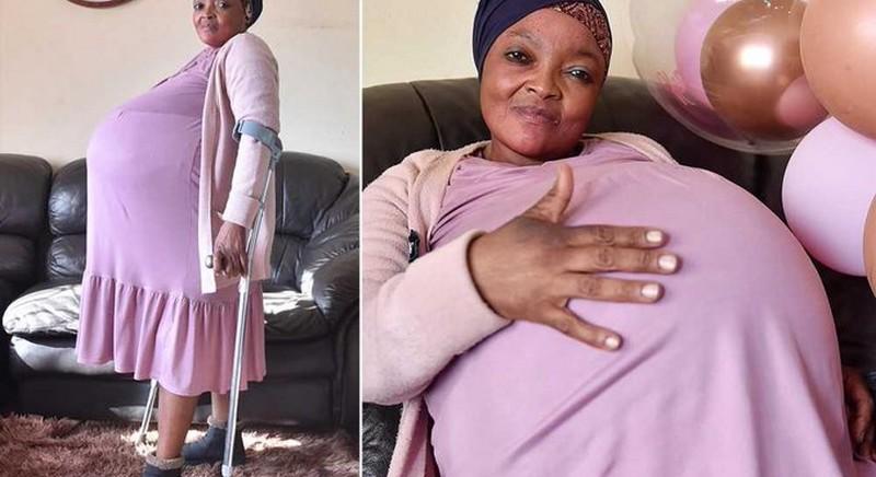 Hihetetlen: tízes ikreket szült egy dél-afrikai nő!