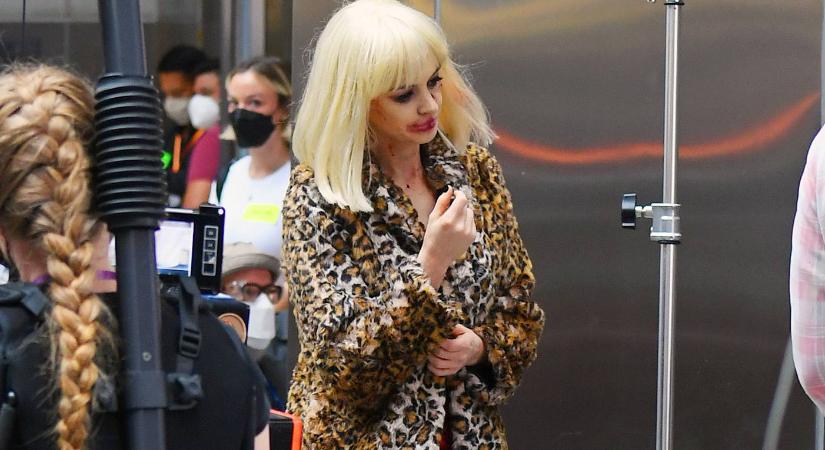 Forgatási képek: Anne Hathaway rémisztően összezúzott arccal jár-kel New Yorkban
