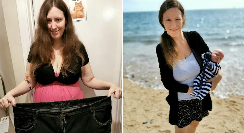 Naponta ötvenszer hányt és 48 kilót fogyott a terhessége alatt, mégis megszülte a babáját egy angol nő