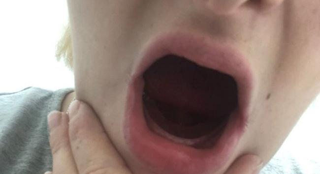 Horrorisztikus: a terhességtől a nő az összes foga kihullott