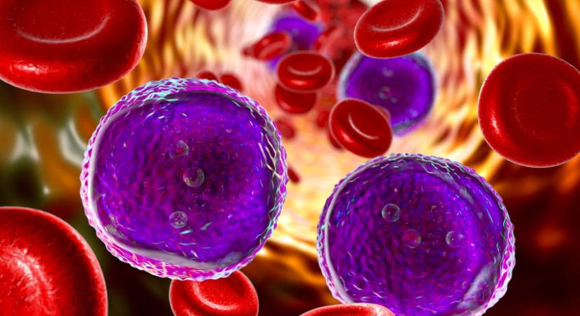 Új vizsgálati eljárás T-sejtes limfoblasztos akut leukémia kezelésére