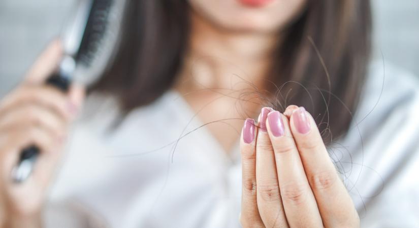 Mi okozhat fokozott hajhullást a nőknél? 5 probléma, ami a haj ritkulásával jár