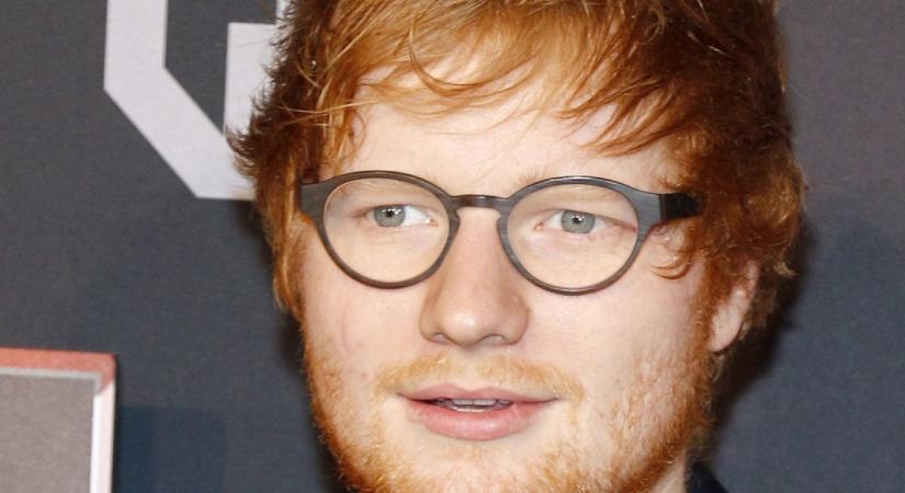 Ed Sheeran ikonikus külseje megváltozik egy műtétnek köszönhetően