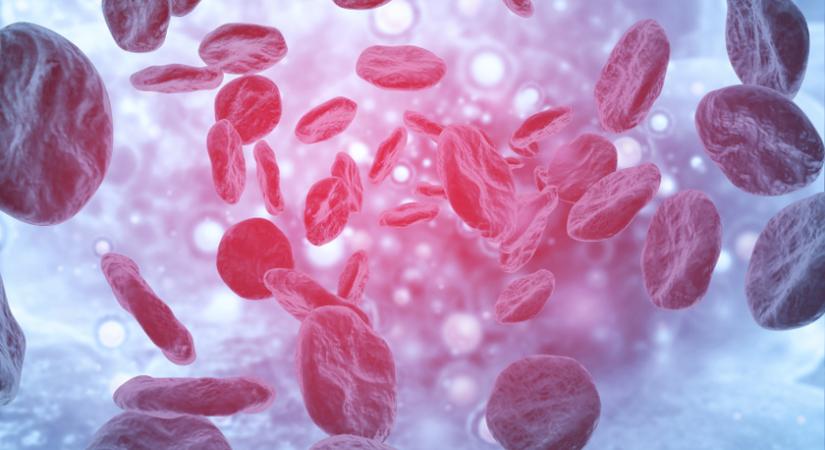 Miről ismerhető fel a vérzékenység, és kiket érint? 5 óriási tévhit a betegségről