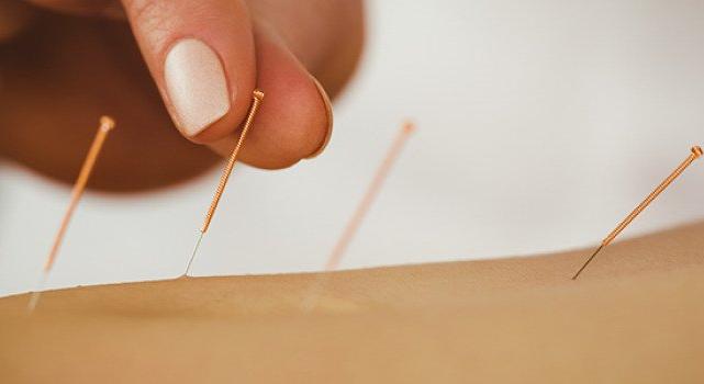 Hogyan műkösik és milyen esetben alkalmazható akupunktúra?