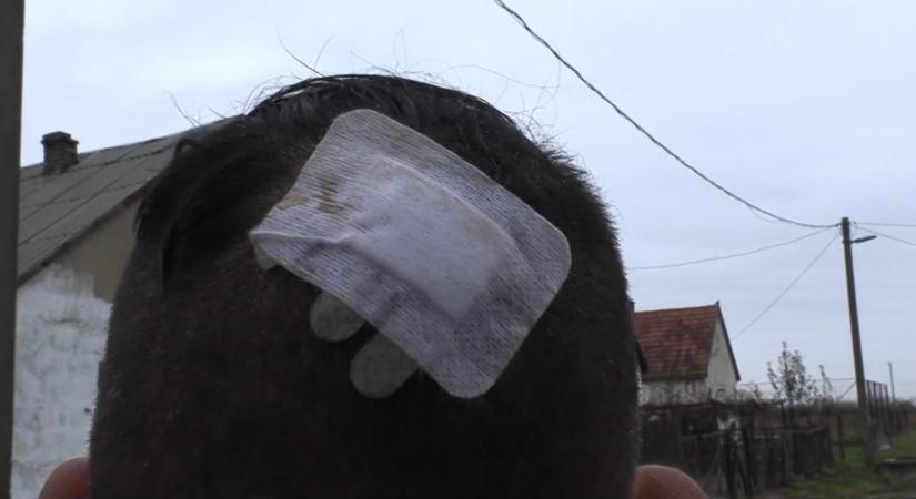 Videó: Gereblyével szakították be a fejét Rozsályon, de senki sem emlékszik, min vesztek össze