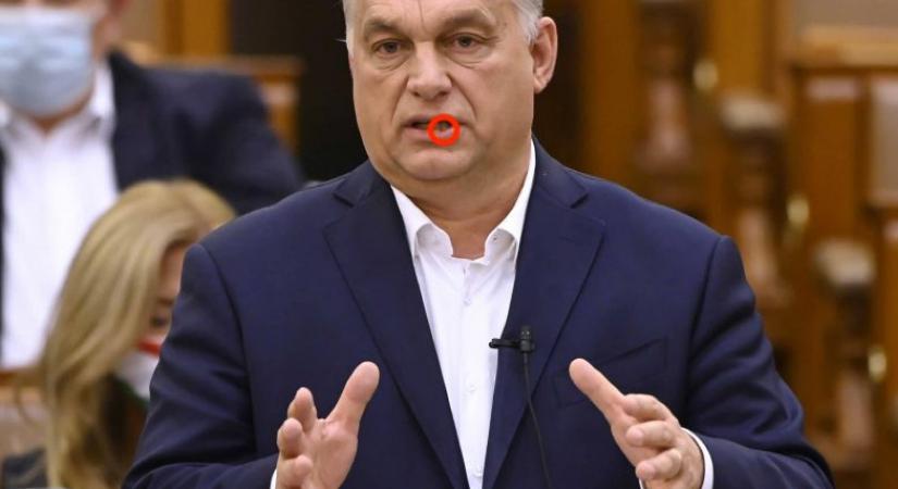 Olvasóink írtak: ez lehet Orbán szájfoltjának titka
