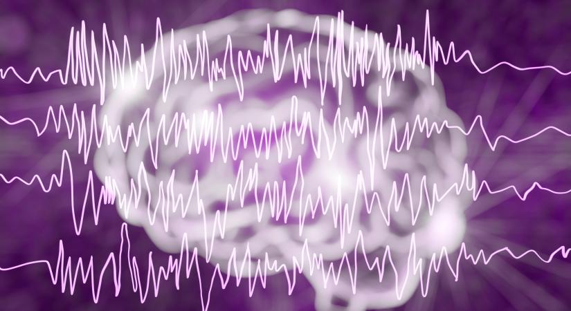 Új módszert fejlesztettek ki az epilepszia kezeléséhez