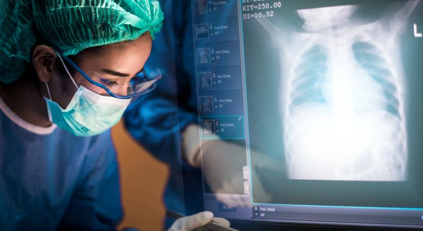 Óriási magyar siker: tüdőátültetéssel mentettek meg egy koronavírusos beteget az Onkológiai Intézetben