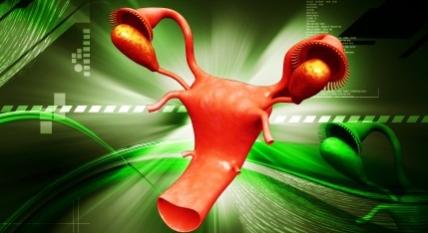 Endometriózisra hajlamosító génváltozatot fedeztek fel