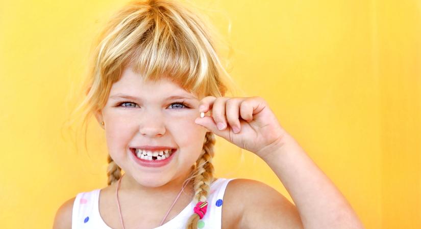 A fogszuvasodás akár már egy éves kor alatt is elkezdődhet