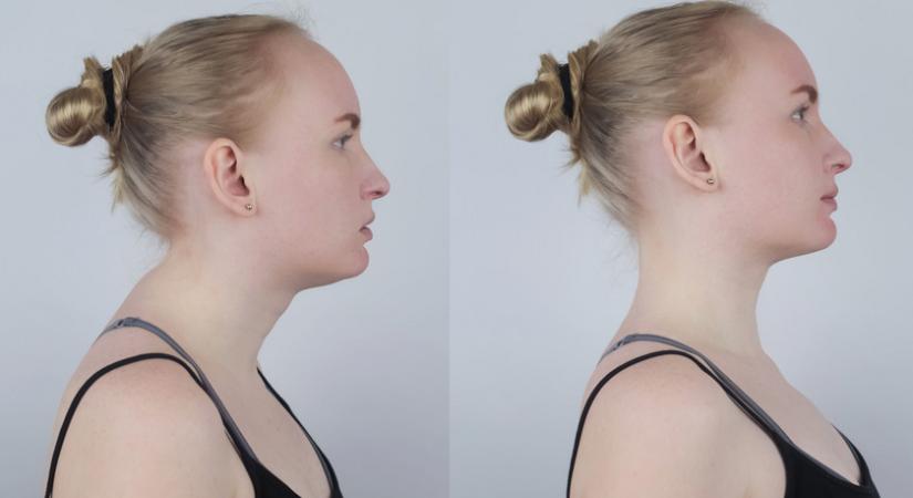 10 hatékony gyakorlat a kellemetlen banyapúp ellen: segítenek visszaállítani a nyak ívét
