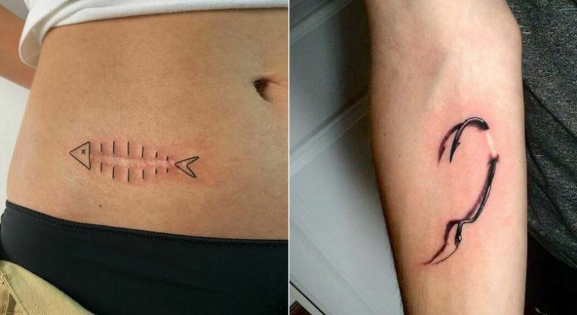 Zseniális módon rejtették el testi hibáikat ezek az emberek: a tetoválásoknak olykor csodás ereje van