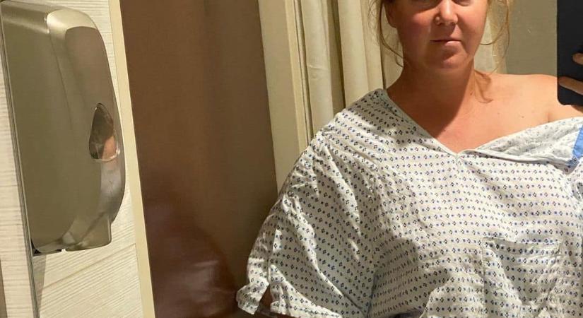Amy Schumer elvesztette a méhét és a vakbelét az endometriózis miatt
