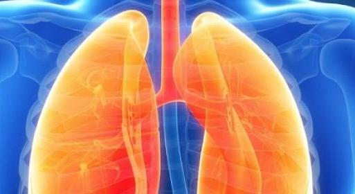 Szeptember – a ritka tüdőbetegségek hónapja. Mi az az IPF?