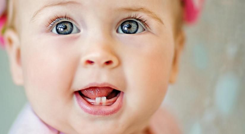 Mindent a gyerekkori fogszuvasodásról - Már egyéves kor alatt kezdődhetnek a bajok
