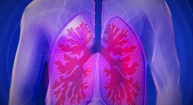 Egy ritka betegség: a tüdőfibrózis