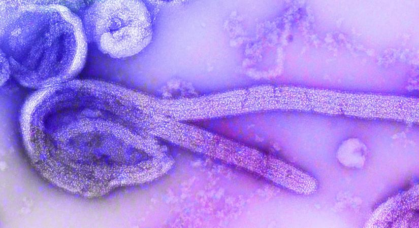 Ebolavírus miatt hunyt el egy hároméves gyermek Kongóban