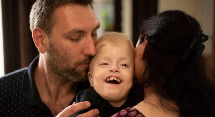 Összefogott Győr a kisfiúért, aki a világon egyedülálló rendellenességgel született