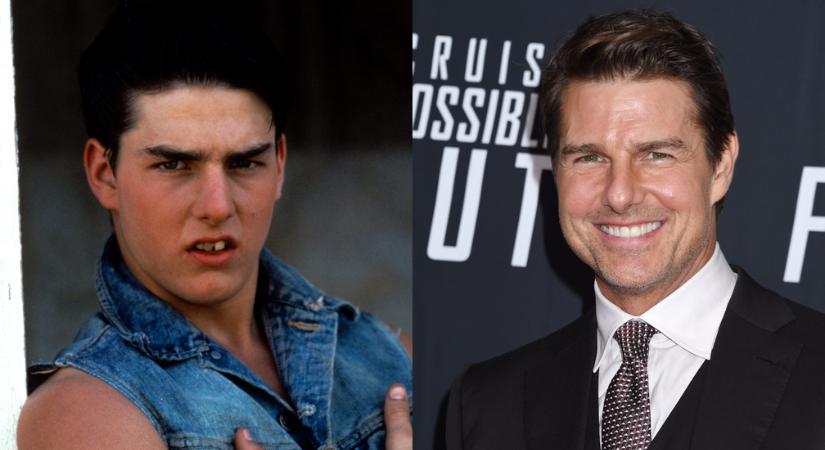 Drasztikus átalakulás: így változott meg az évek alatt Tom Cruise arca