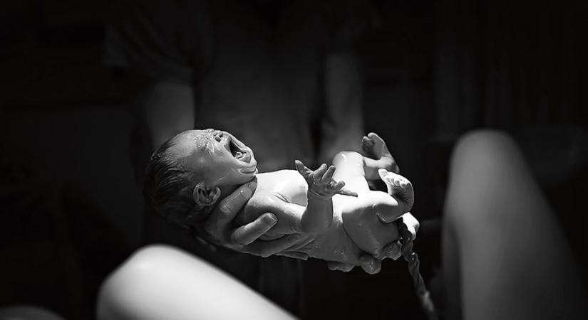 Szülés választott orvos nélkül – Kire számíthat a kismama?