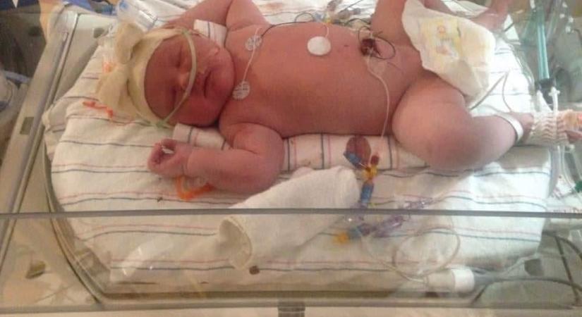 Brutális: 14 kilós babát szült egy amerikai nő – képek