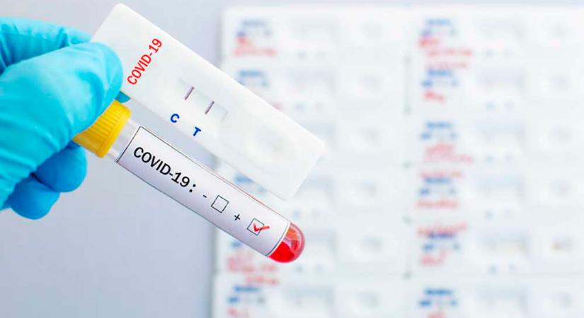 COVID – Fontos az antigéngyorsteszt a háziorvosoknál