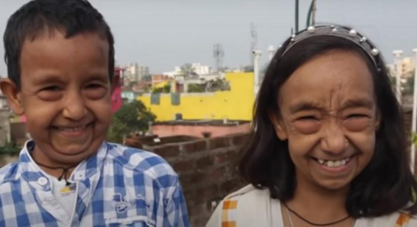 A Benjami Button testvérpár: az indiai gyerekek idősebbnek néznek ki, mint a szüleik