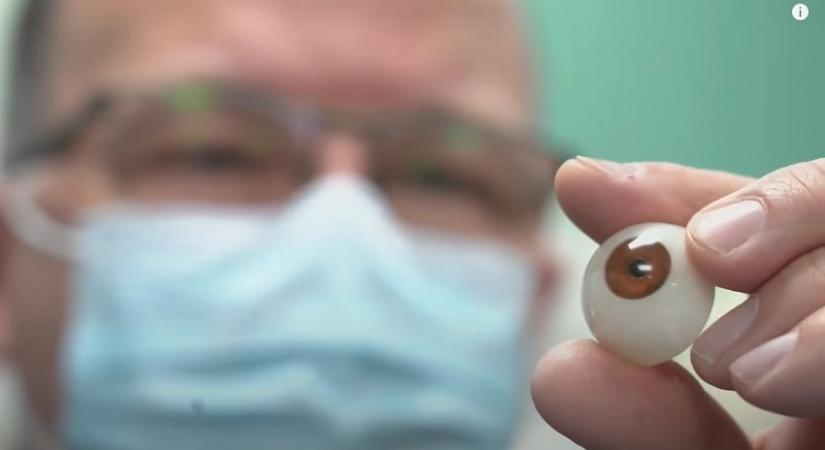 A világon először 3D nyomtatóval készült szemet kapott egy férfi