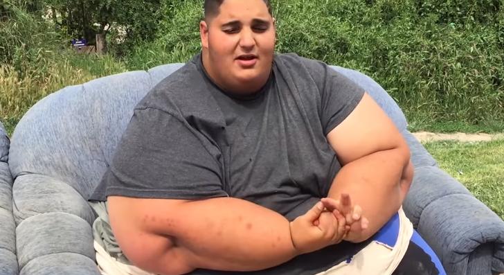 17 évesen 294 kilót nyom Géza, már csak egy műtét segíthet rajta