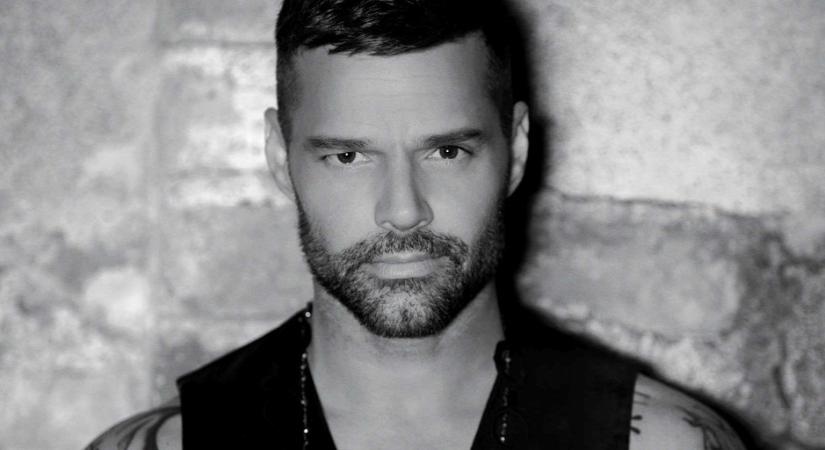 Nem tudott leállni! Ricky Martinra akart hasonlítani, ezért harmincszor feküdt a kés alá - Fotó