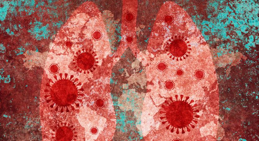 Veszélyt jelent a koronavírus kistestvére: mutatjuk, mit érdemes tudni a tüdőgyulladásról, illetve a poszt-covid tüdőgyulladásról