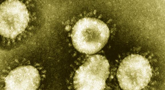 Amit a koronavírus-újrafertőződésről tudni lehet