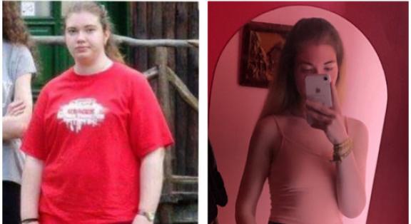 Elképesztő fogyássztori: 65 kilót fogyott a 20 éves Lili, elárulja, hogyan