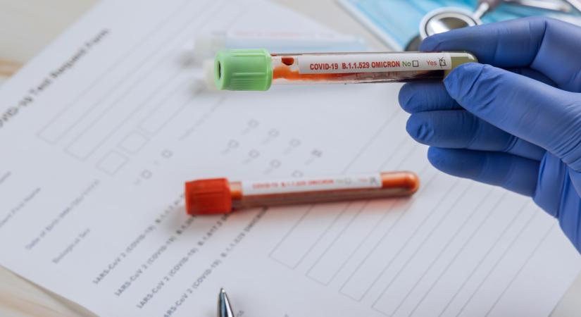 A Semmelweis Egyetem felfüggesztette azt az orvost, aki hamis PCR-teszteket állított ki