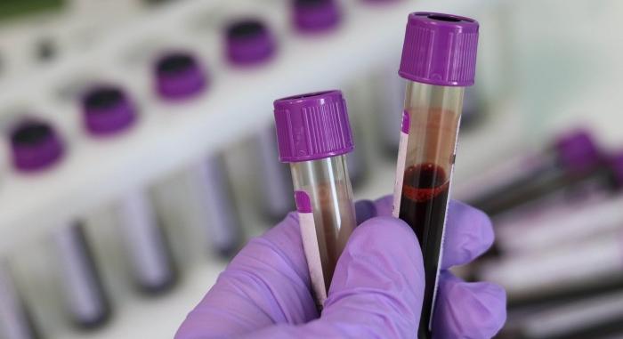 Beutaló nélküli vérvétel, laboratóriumi vizsgálat, vérvizsgálat 20%-os kedvezménnyel