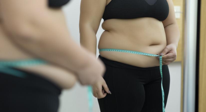 A világ egyik legkövérebb országa Magyarország: súlyos egészségügyi problémákhoz vezethet a túlsúly