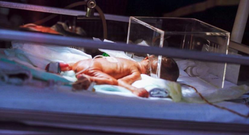 Hazaengedték a kórházból a fél kilóval született koraszülött babát
