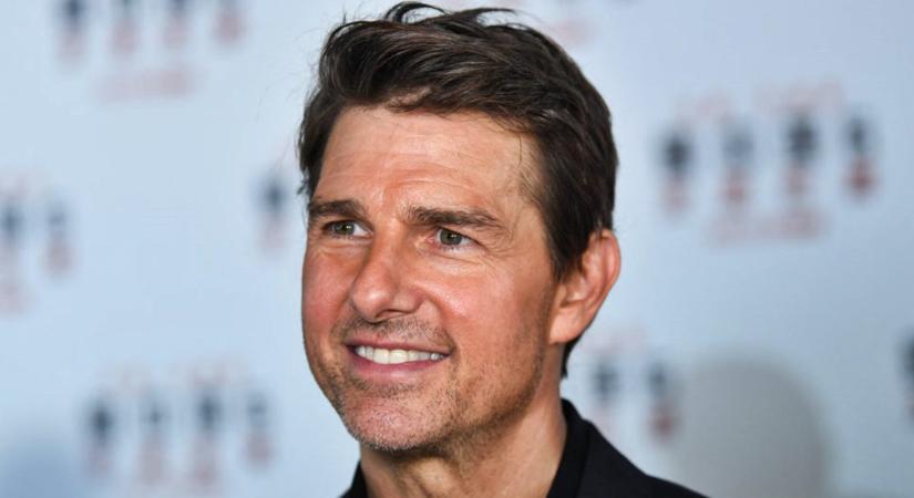 Tom Cruise évtizedek óta küzd szépséghibájával – Te tudod mi az?