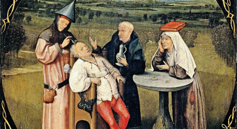 Hosszú évszázadokon át ijesztő gyógymódokkal akarták elűzni a fejfájást