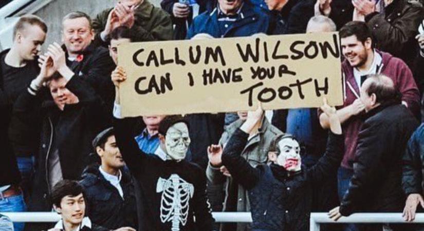Videó: a Newcastle játékosának fogát kiverték – zseniálisan reagált